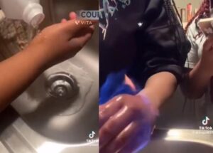 家長看過來！12歲男童模仿抖音「火災挑戰」　全身著火嚴重燒傷昏迷